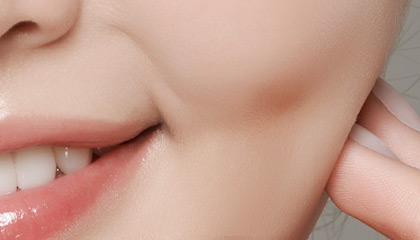 酒、梨窩整形手術 酒、梨窩整形手術